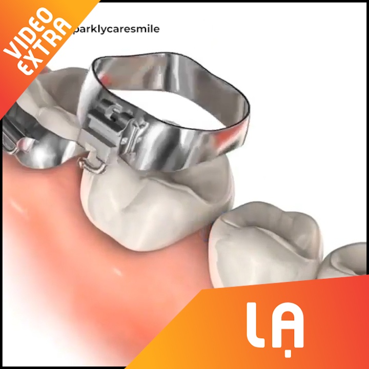 Can canh cac cong doan cua qua trinh nieng rang hinh anh