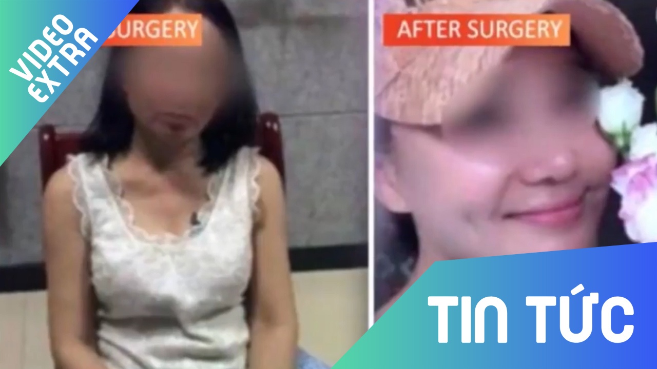 Nguoi phu nu 60 tuoi phau thuat thanh gai tre 20 tuoi de tron no hinh anh