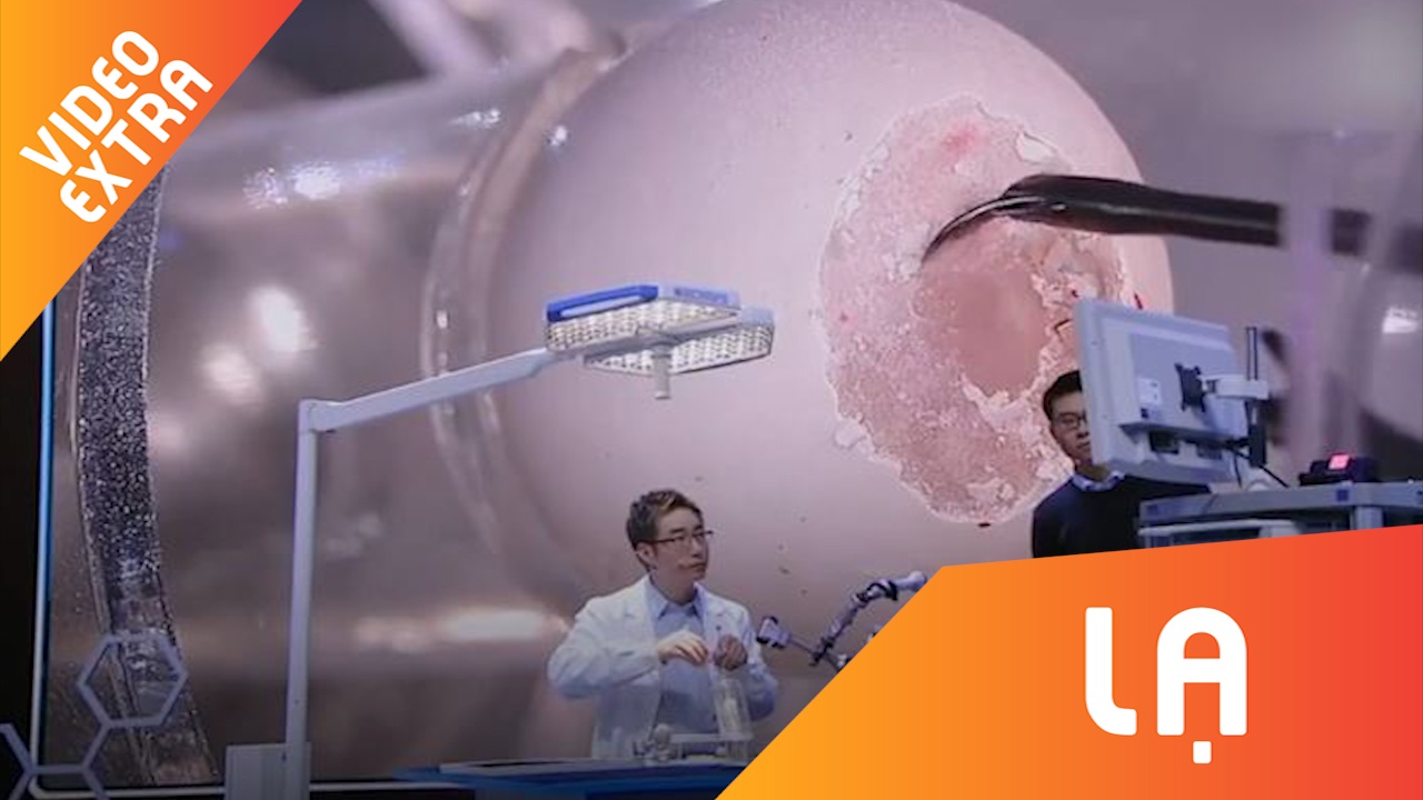 Ky thuat dang ne cua bac sy phau thuat, mo va khau lop mang trung ga hinh anh