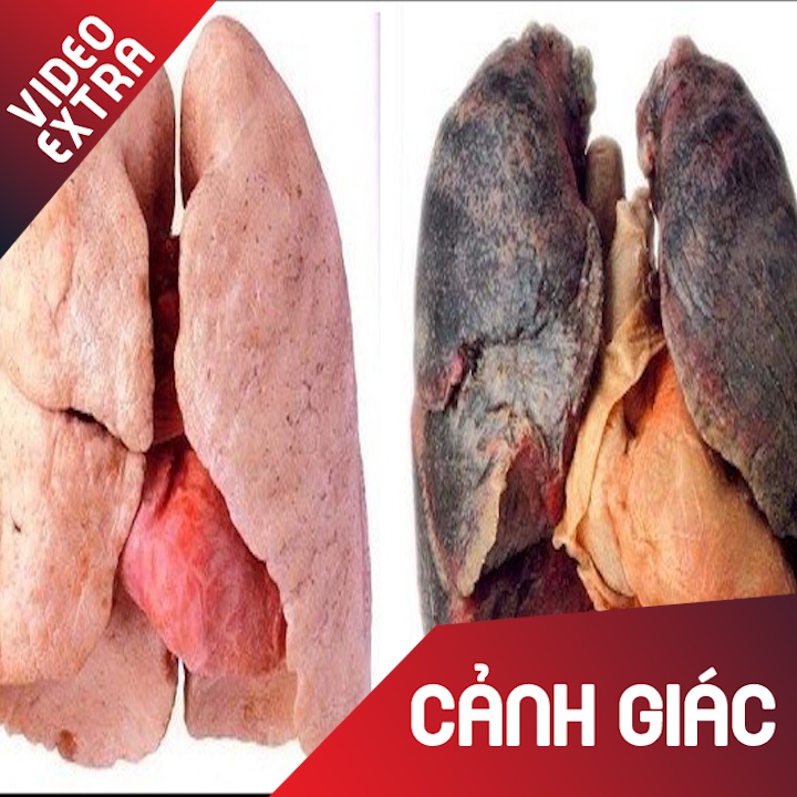 Thi nghiem cho thay thuoc la tan pha phoi khung khiep ra sao hinh anh