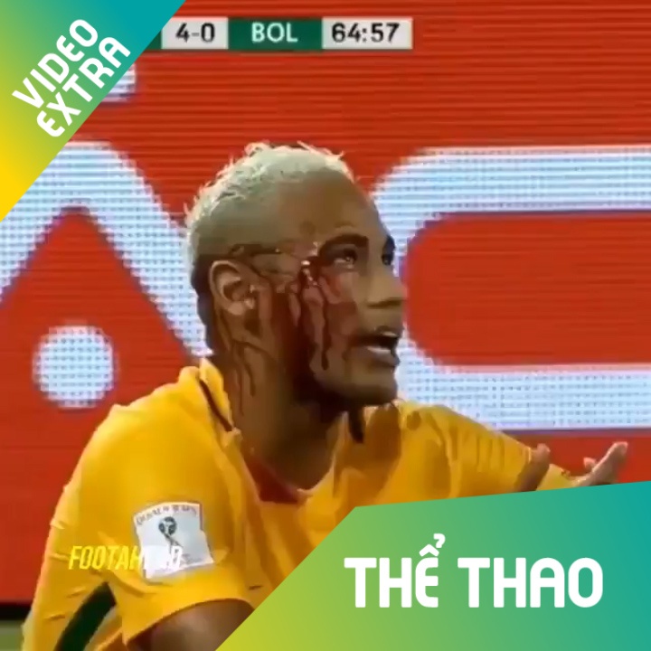 Ronaldo va nhung cau thu tuon mau 'nhu mua' sau cac pha danh nguoi hinh anh