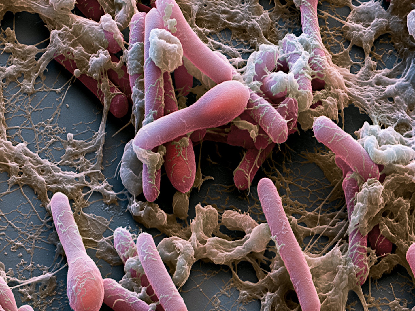 Loai chat huy diet ca thanh pho chi voi khoi luong 1 gram hinh anh