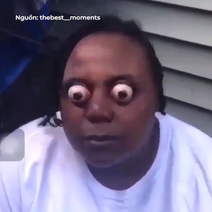 Co nang ky di voi doi mat loi ra khoi trong tuy y hinh anh