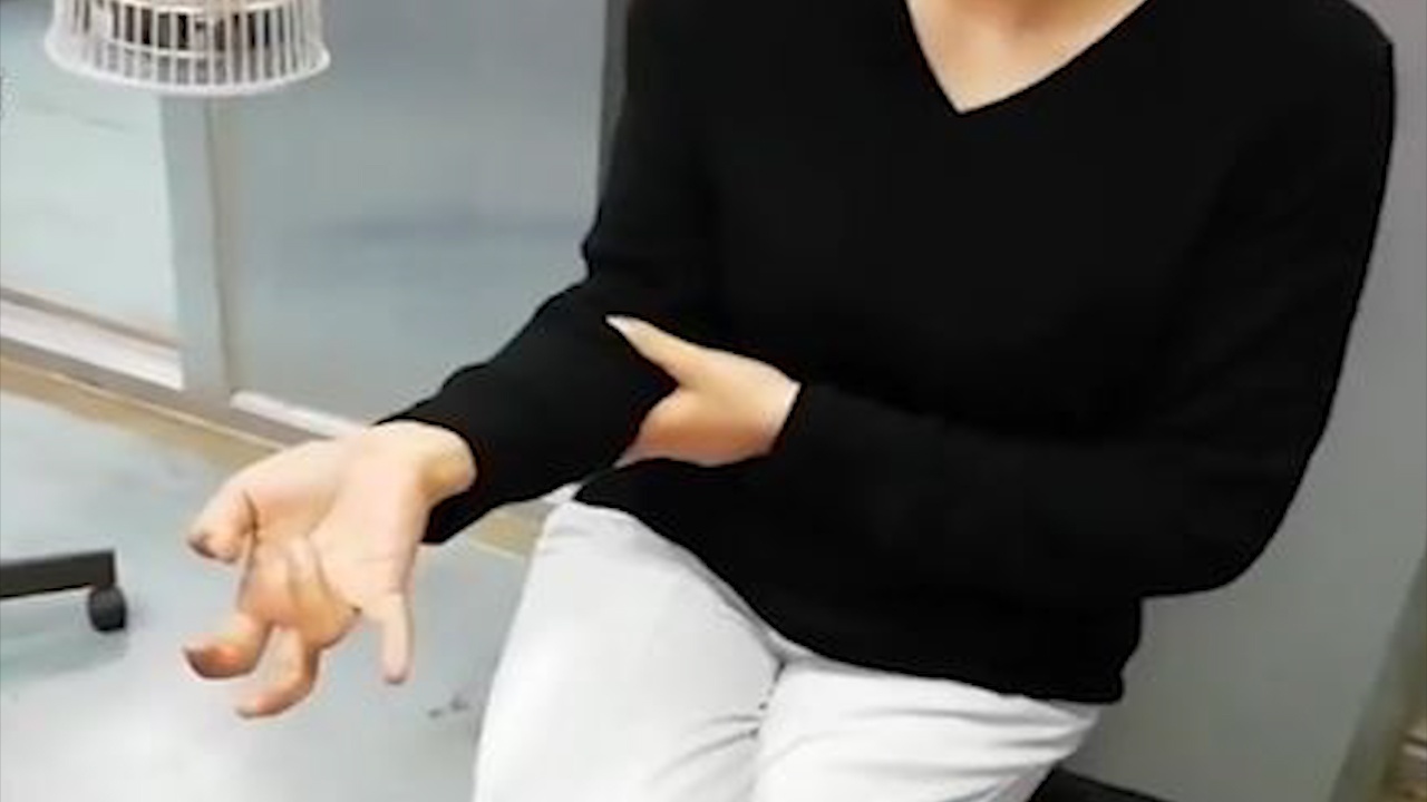 Nguoi phu nu khong the cu dong tay vi su dung dien thoai qua lau hinh anh