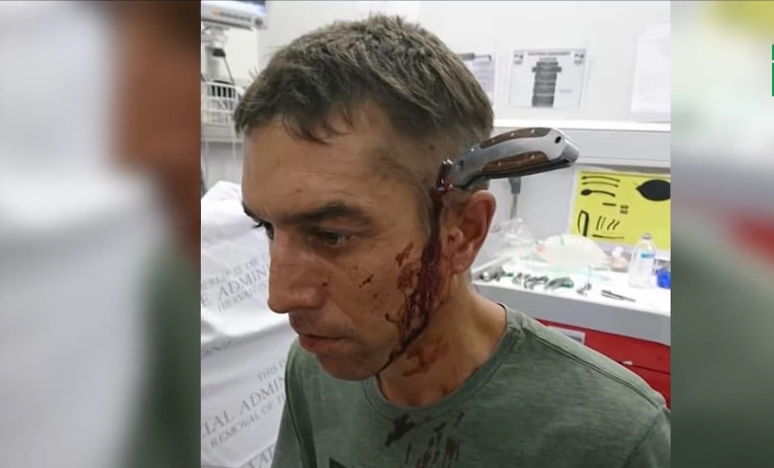 Bi dao dam xuyen dau van tinh tao dap xe den benh vien hinh anh