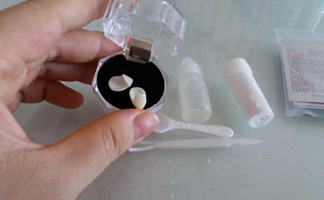 Mua rang gia gan vao rang that, trao luu lam dep nguy hiem hinh anh