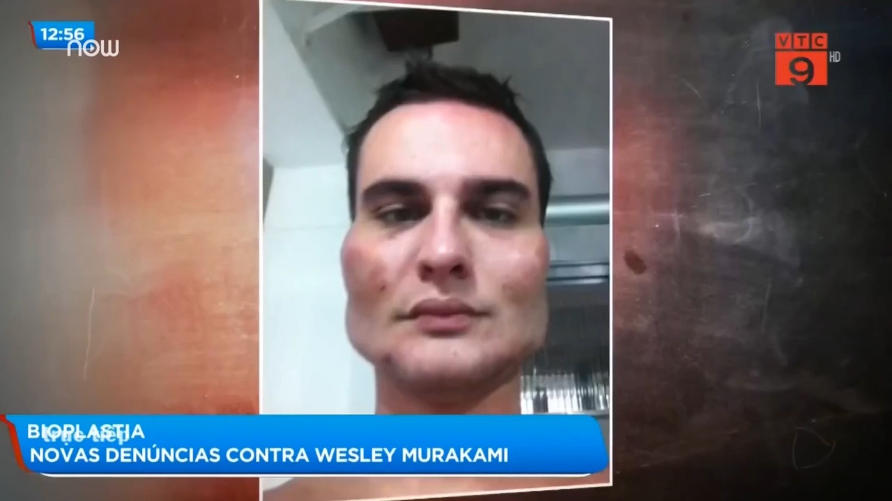 Bac si khien hang chuc benh nhan bien dang mat, khong the phuc hoi hinh anh