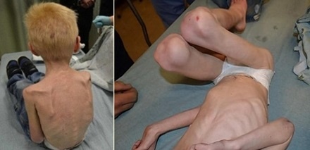 Me ke My tan nhan nguoc dai, bo doi con chong chi con da boc xuong hinh anh