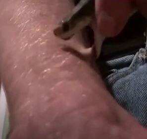 'Di nhan' tu tiem noc ran, bi ran can hang tram lan khong chet hinh anh