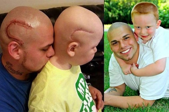 Cam dong nguoi cha My xam hinh giong vet seo de giup con tu tin hon hinh anh