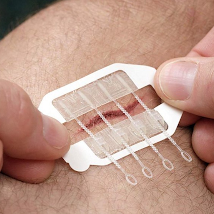 Mieng dan tien loi giup khep vet thuong ho mau hon hinh anh