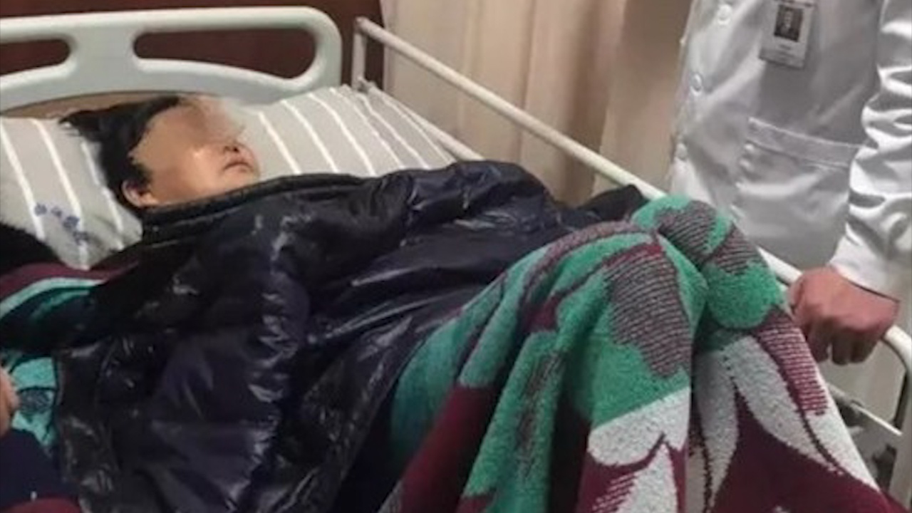 Vo gay xuong sau cai om cua chong hinh anh