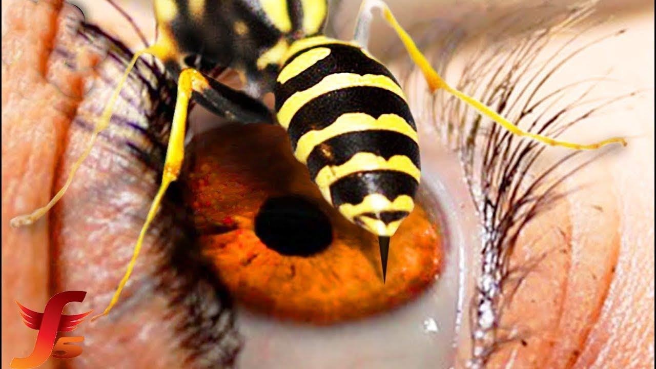 Thu gi khien con nguoi dau don nhat? hinh anh