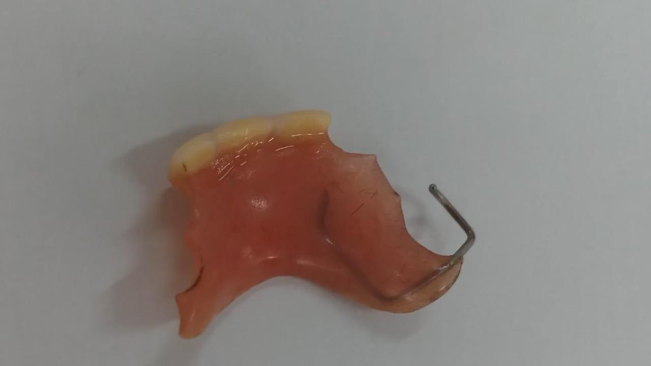 Nguoi phu nu khong may nuot luon rang gia khi an sang hinh anh