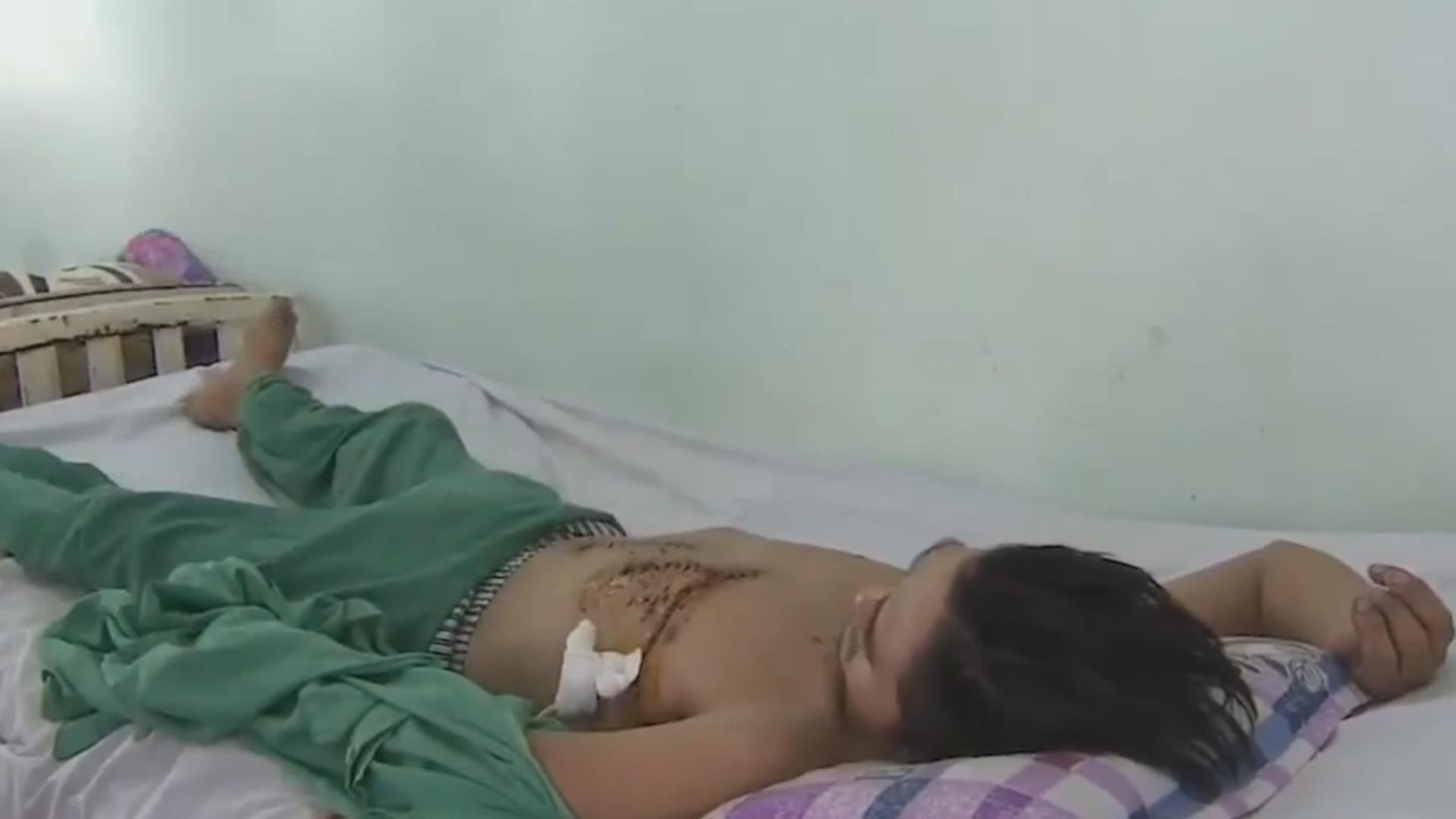 Ngao da mat kiem soat hanh vi, gay nguy hiem cho ban than hinh anh