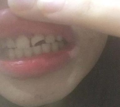 Thuc hu vu gay tai nan de xam hai cac co gai hinh anh