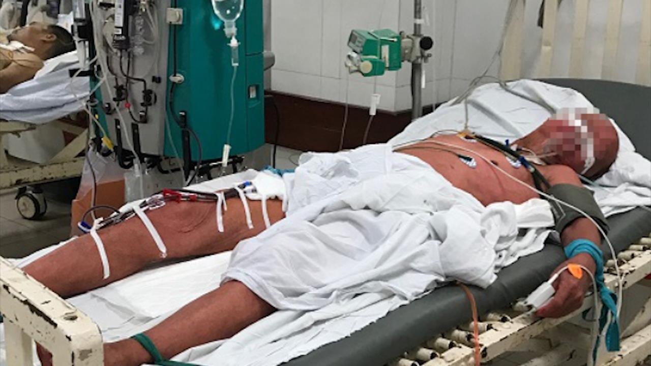 Cu ong do da, nhap vien vi uong nham thuoc nhuom pham mau hinh anh