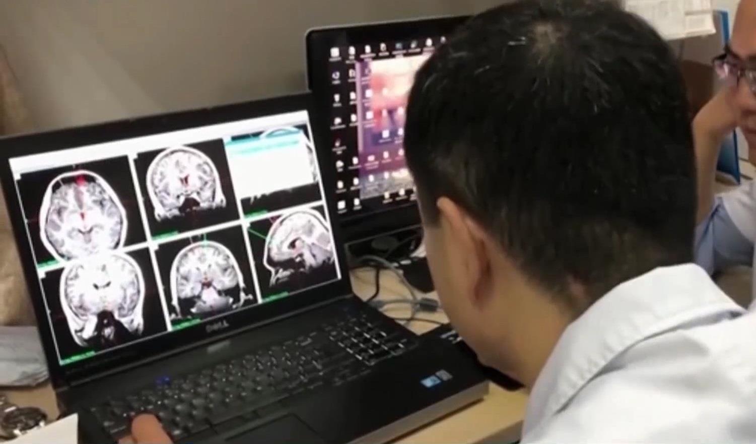 Cai nghien ma tuy da bang phuong phap cay nao hinh anh