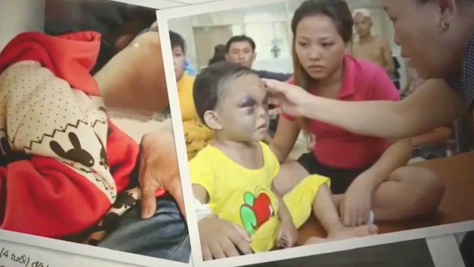 Day con bang cach danh don lieu co dung? hinh anh