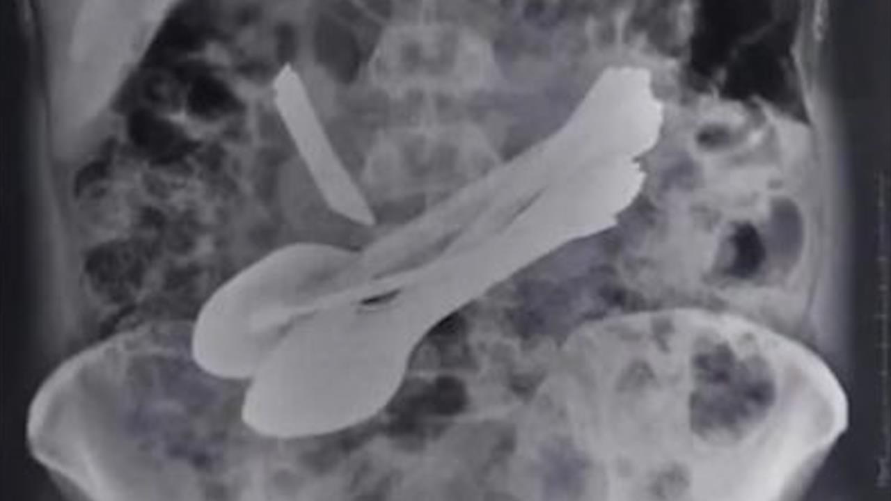 Di nhan An Do nghien an ban chai, thia, dao hinh anh