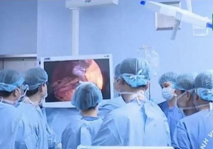 Co gai cat bot da day de giam can nhanh hinh anh