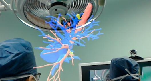 Phau thuat tim noi soi nho cong nghe 3D tai Trung Quoc hinh anh