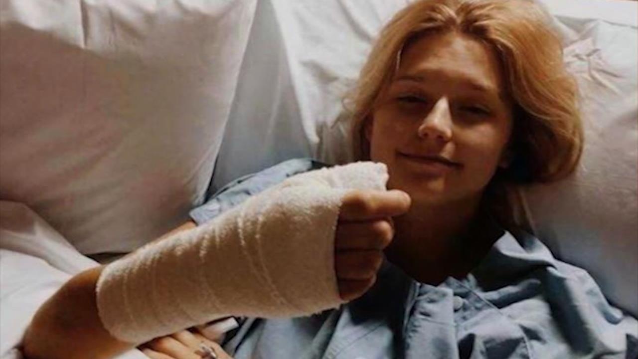 Co gai Australia phai cat bo ngon tay vi thoi quen can mong tay hinh anh