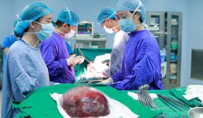 Phau thuat thanh cong khoi u mau khong lo o gan hinh anh