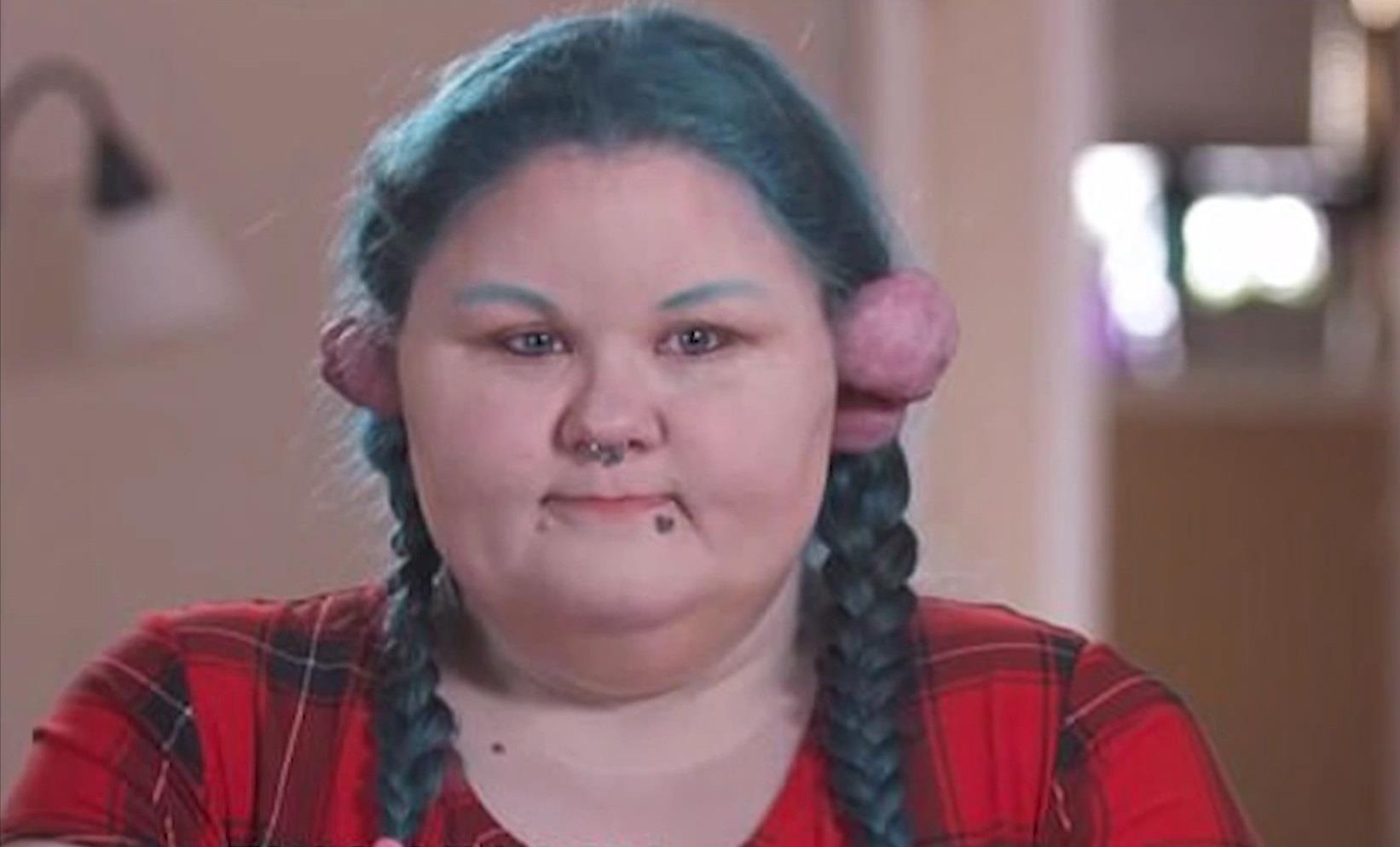 Tai nhiem trung, sung phong nhu qua bong do bam khuyen hinh anh