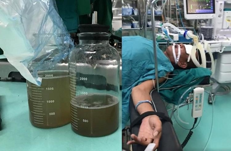 Tai xe suyt chet vi dung mieng hut dau diesel hinh anh