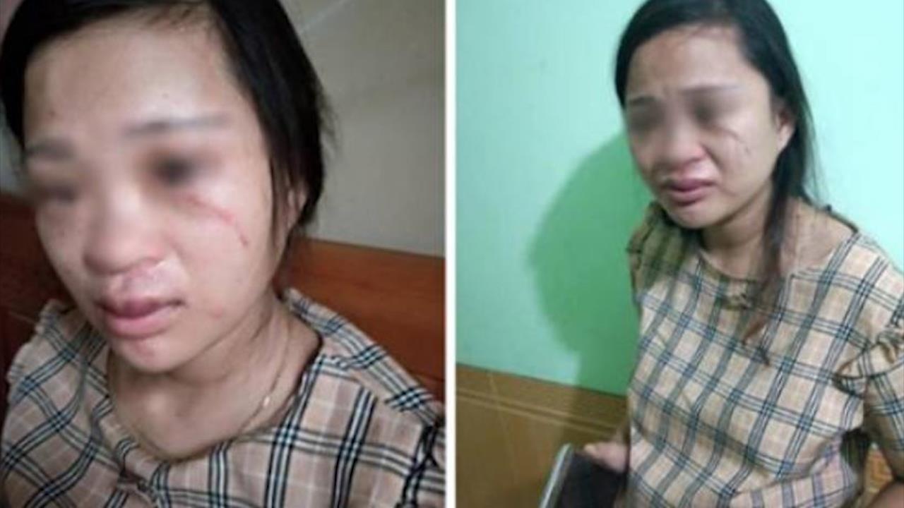 Vo bi danh dong thai vi mua giay khong hoi y kien chong hinh anh