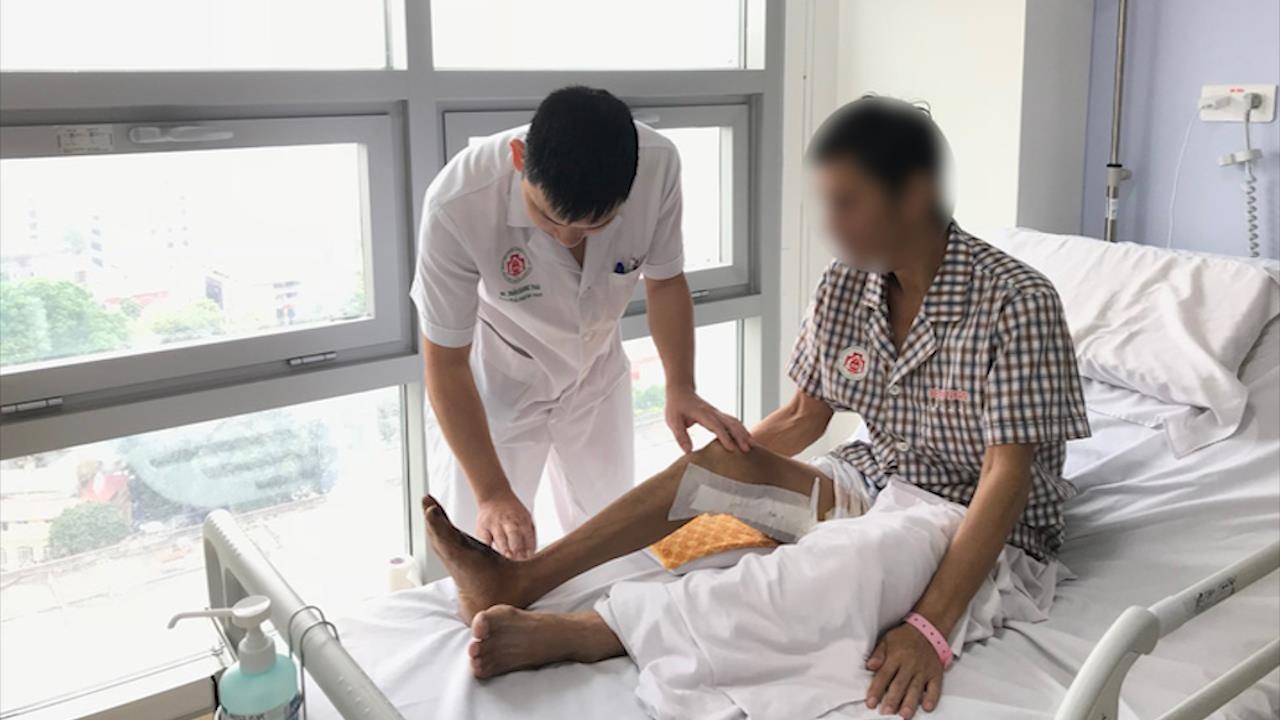 Hut thuoc la co nguy co bi mat ca tay, chan hinh anh