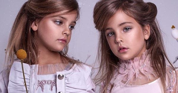 Cap chi em song sinh dep nhat the gioi kiem ca trieu USD moi nam hinh anh