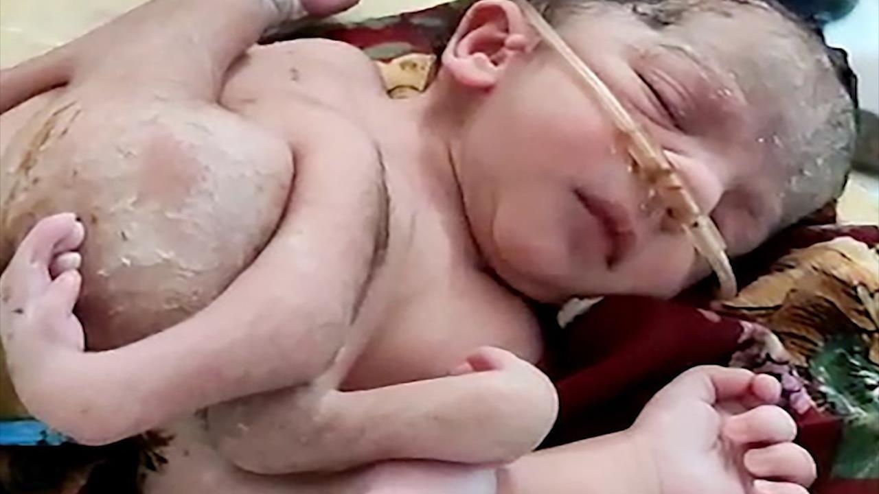 Em be An Do chao doi voi 4 chan va 3 tay hinh anh