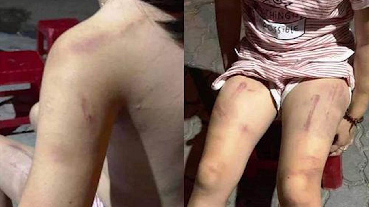 Cu noi vung gay danh be gai bam tim khap nguoi hinh anh