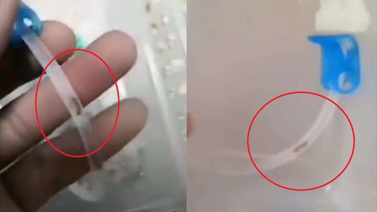 Nguoi cha tuc gian khi thay sau trong ong truyen dich cua con trai hinh anh