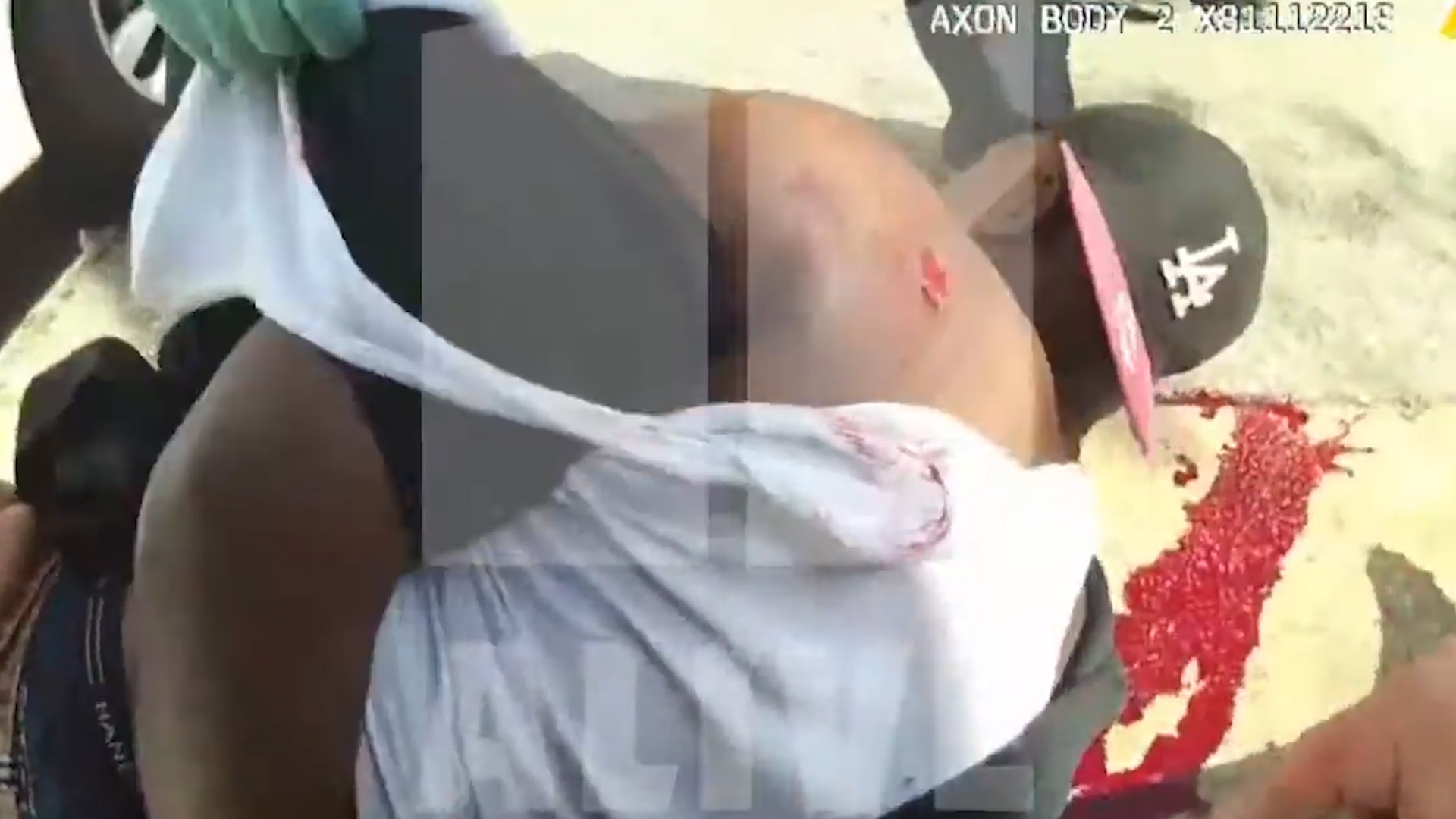 Canh sat My ban guc nghi pham roi co gang cuu chua hinh anh