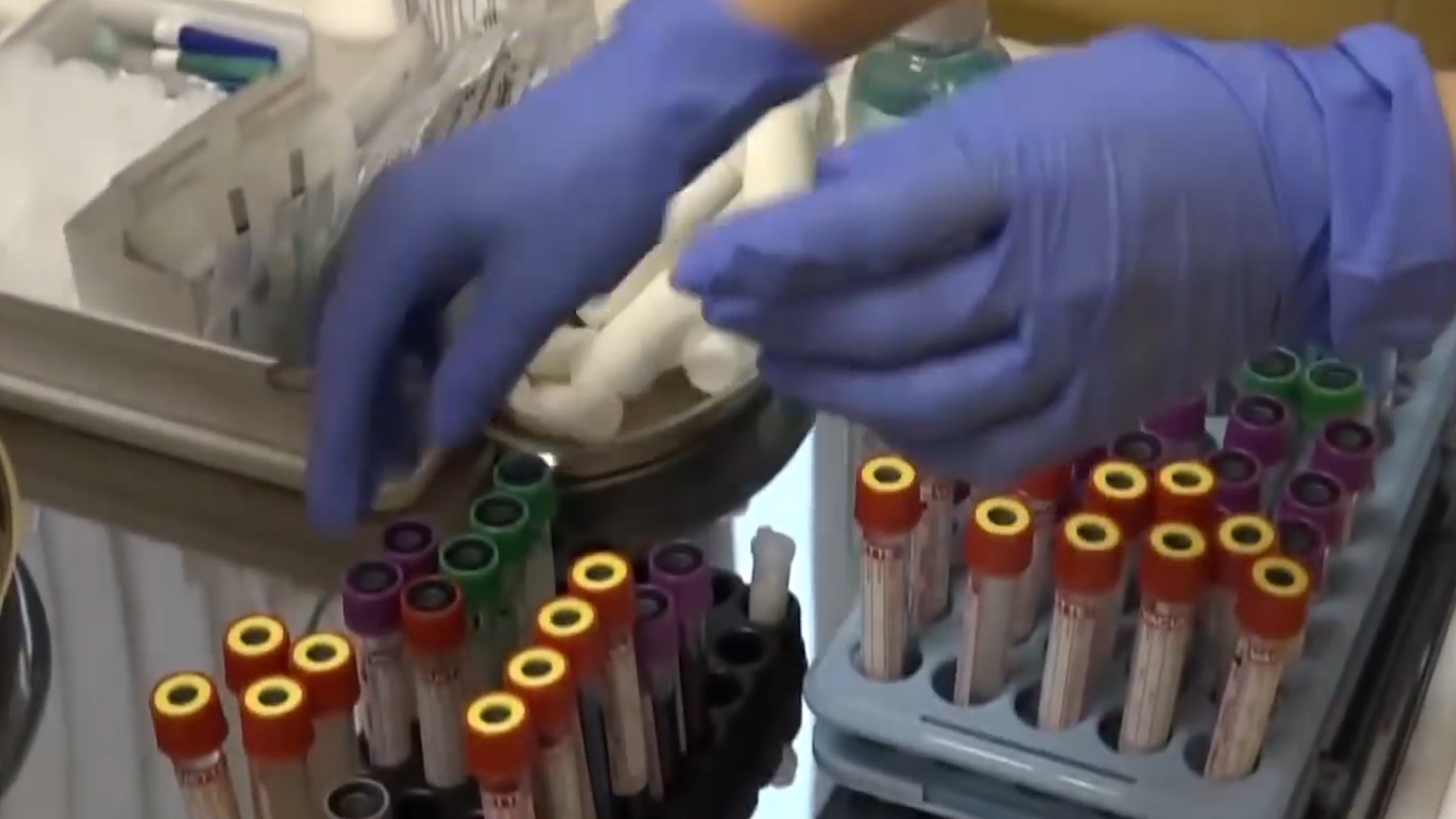 Hang nghin nguoi tai Nga cay chip vao co the de song lau hon, khoe hon hinh anh