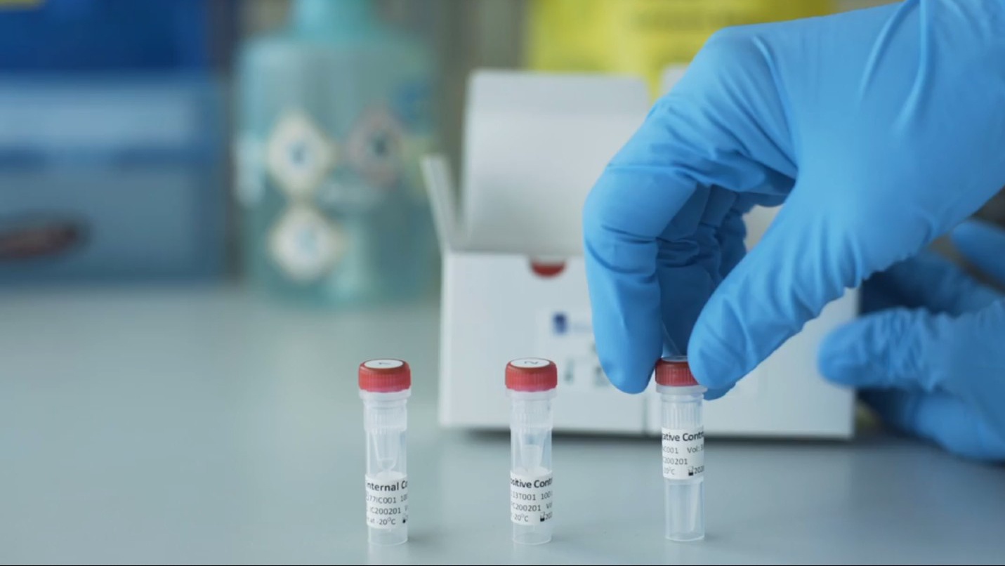 Bo dung cu xet nghiem virus corona hoat dong nhu the nao? hinh anh