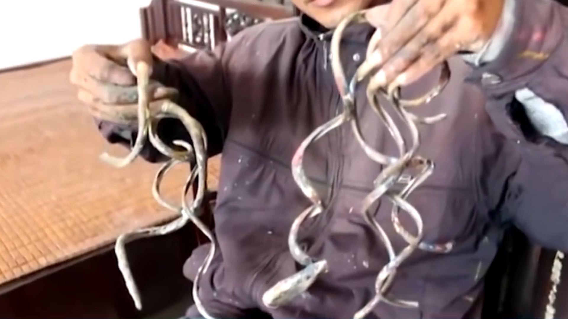 Di nhan 35 nam khong cat mong tay o Nam Dinh hinh anh