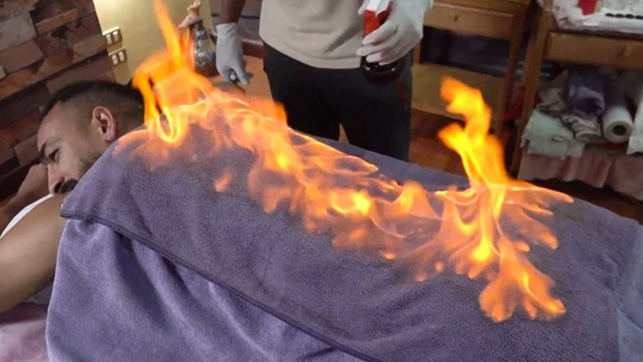 Cau thu Ai Cap tri lieu bang lua de chong Covid-19 hinh anh