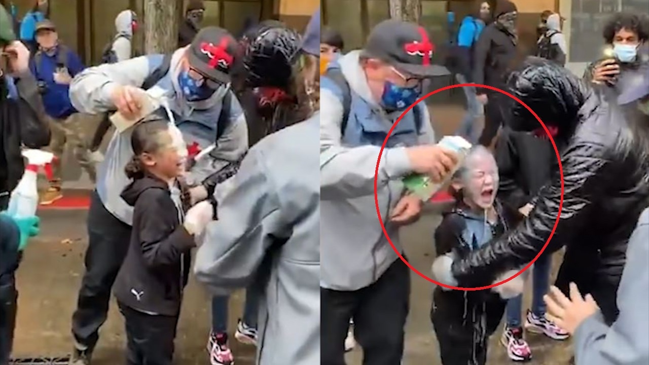 Be trai 7 tuoi om mat dau don vi bi canh sat xit hoi cay bua bai o My hinh anh