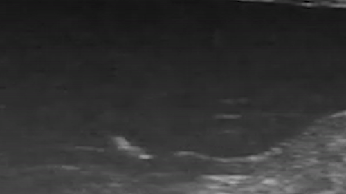 Robot sieu nho di chuyen tinh vi trong ruot hinh anh