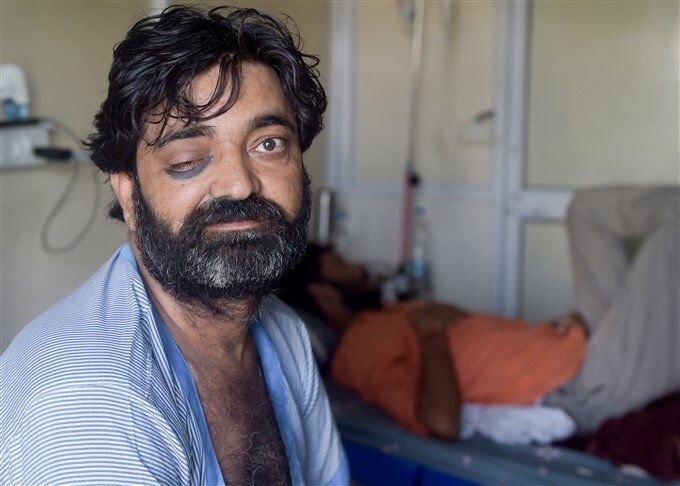 Gan 41.000 nguoi mac benh nam den o An Do hinh anh