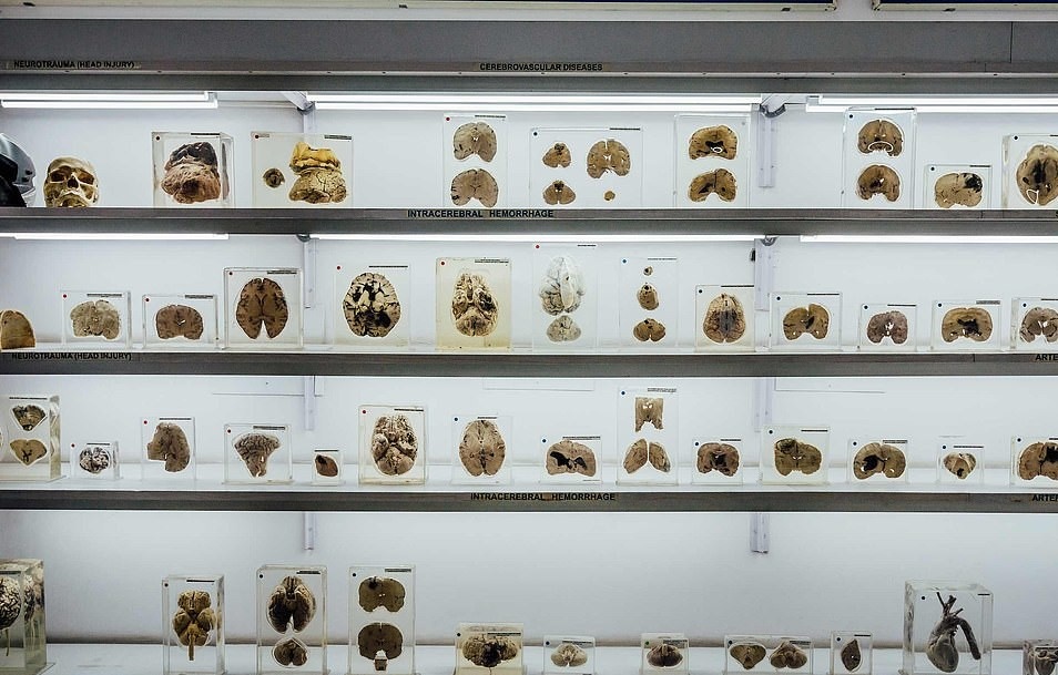 Bảo tàng não người ảnh 2 Bao tang nao nguoi anh 2