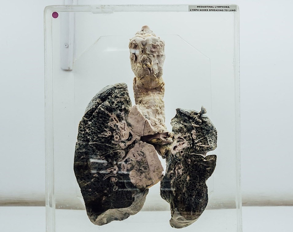 Bảo tàng não người ảnh 3 Bao tang nao nguoi anh 3