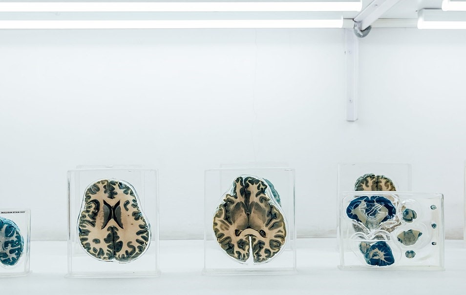 Bảo tàng não người ảnh 5 Bao tang nao nguoi anh 5