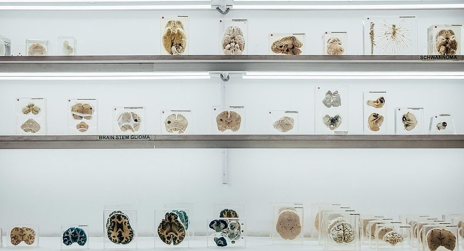 Bảo tàng não người ảnh 6 Bao tang nao nguoi anh 6