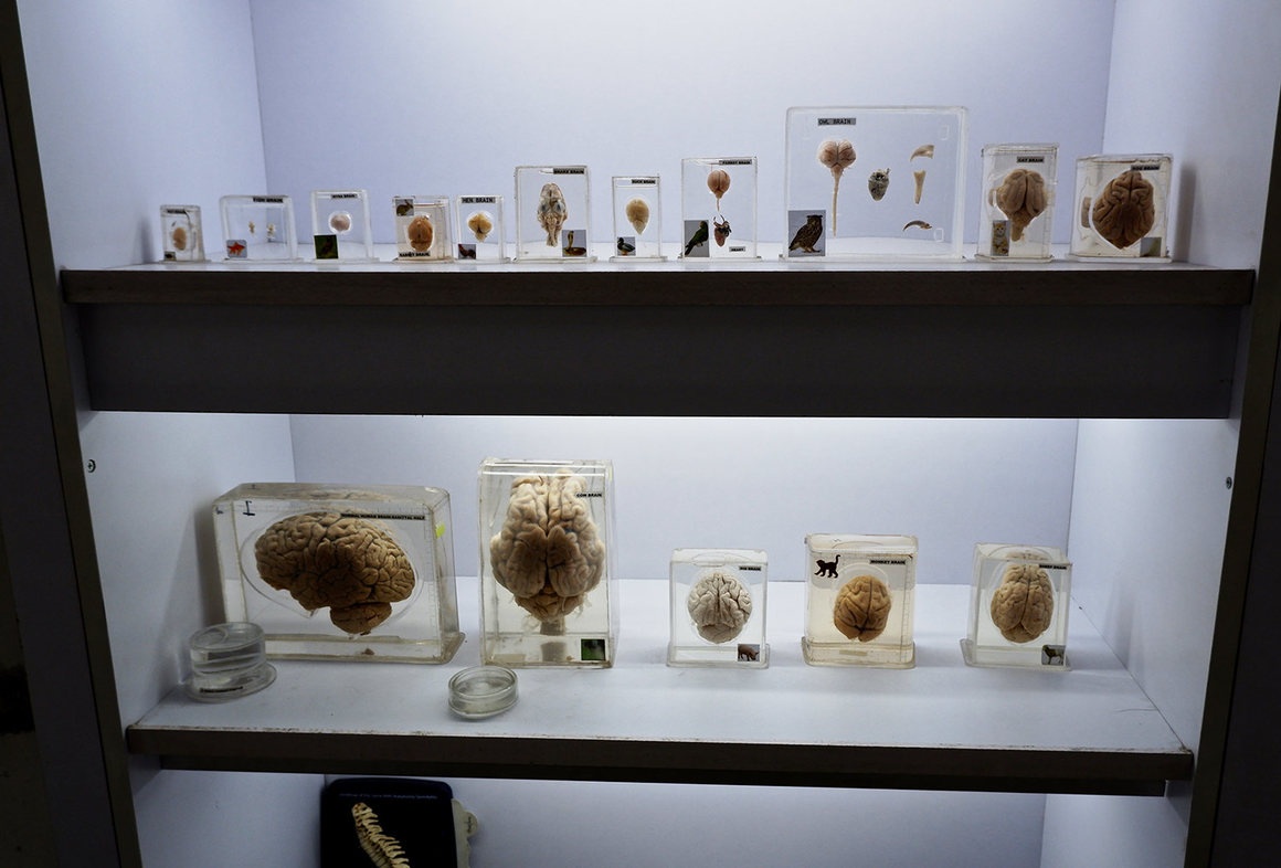Bảo tàng não người ảnh 8 Bao tang nao nguoi anh 8