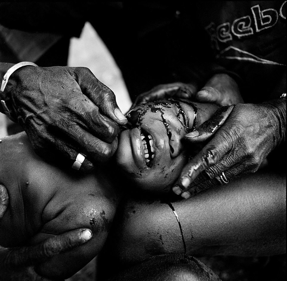 Hu tuc rach mat tre em anh 6